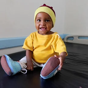 ch1565723-malnutrition-survivor-noor-visits-hospital-for-a-checkup-with-her-mother-safiya-31_1